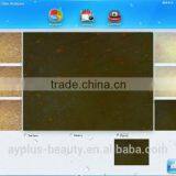 AYJ-J016 Promotion Product Portable Hair Analysis Equipment Beauty Equipment thumbnail-4