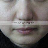 Non-surgical No-wound Hifu Anti-aging Face Lift Machine With 3 Cartridge Different Treatment thumbnail-4