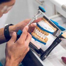 Dental Implants China Dental Lab | Dental Lab Outsourcing Service thumbnail-2
