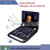 (MSLCU18)3D 4D Handheld Color Doppler Medical Ultrasound Scan Machine thumbnail-6