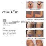 Beauty Salon Use Ultrasound Shap Fat Removal With CE Certificate thumbnail-6