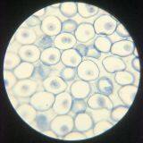 Lab and Medical Pathology Histology Microscope Slides thumbnail-5