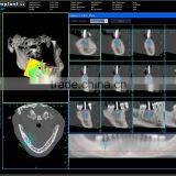 Implant Software - CT