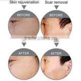 4 In 1 Oxygen Jet Face Lift Peeling Skin Rejuvenation Multifunction Machine CE Dispel Black Rim thumbnail-3