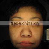 Good Price Skin Analyzer Machine Skin Scope Machinery/face Skin Analysis/uv Skin Analyzer Machine for Beauty Salon thumbnail-2