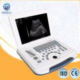 Me-580 Ultrasound Machine Digital Ultrasound Diagnostic