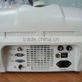 CE Approved Portable Ultrasound Scanner With 3.5Mhz Multi-frequency Convex Probe RUS-6000A thumbnail-3