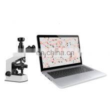 Advanced Factory Medical Sperm Quality Testing Analyzer Automatic Sperm Semen Analyzer Extractor thumbnail-2