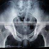 China KND-A/F CE Medical Dry Film Agfa Healthcare thumbnail-2