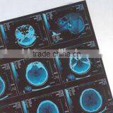 China Radiology Accessories, Medical Accessories thumbnail-1