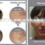 Red Light Therapy For Wrinkles Professional Suslaser PDT Red Led Light Therapy Machine Improve fine lines thumbnail-6