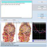 2017 Factory Health Analyzer 9DNLS Body Nls Diagnostic System thumbnail-5