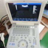 4D Baby Portable Medical Color Doppler Ultrasound Machine thumbnail-2