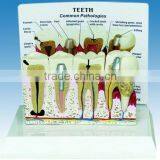 Teeth Model With Description Plate