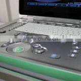 C7 KONTED 3D Portable Color Doppler Ultrasound Machine thumbnail-3