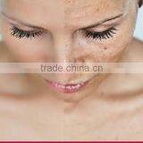 Rf Metal Tube Laser Equipment Spot Scar Pigment Removal Fractional Co2 Laser For Sale Stretch Mark Removal thumbnail-6