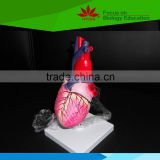 Best selling human enlarged heart model