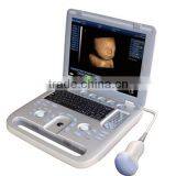 MCB-E5B 15in LCD Digital Laptop Ultrasound Scanner thumbnail-1