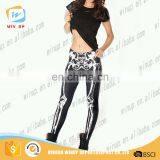 Spring And Summer Ladies Fitness Leggings Sex Korea Sport Leggings thumbnail-1