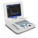 Ultrasonic, Optical, Electronic Equipments Laptop Portable B pc Based Ultrasound Scanner thumbnail-4