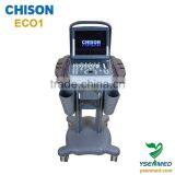 Medical B/w 2d Portable Ultrasound Chison Eco1