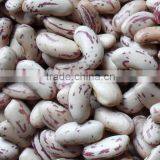 Light Speckled Kidney Beans thumbnail-1