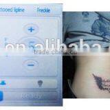 Pigmented Lesions Treatment Merry Christmas! Portable Nd Yag 800mj Tattoo Removal Machine Q Switch Laser For Q1 thumbnail-4