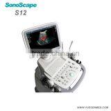 Full Digital Color Doppler Ultrasound Machine Sonoscape S12 Price thumbnail-3