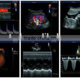 High Quality 3D Color Doppler Ultrasound Machine With Internal Report thumbnail-3