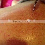 30MHz RBS ROYAL-VR360 Spider Vein Removal Machine thumbnail-4