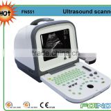 FN551 HOT selling CE approved full digital ultrasound scanner price