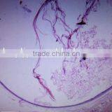 Mucoepidermoid Carcinoma Teaching Accessories Human Oral Pathology Medical Prepared Slides