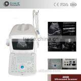 Portable Digital Ultrasound Scanner With SVGA Screen Transvaginal + Convex Probe 200C+ thumbnail-3