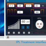 Permanent Hair Removal Shr Laser Hair Removal Instrument Non-painful