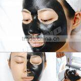 800mj Body Tattoo Removal Q 1 HZ Switched Nd Yag Laser Machine 0.5HZ thumbnail-6