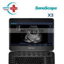 Cheap Medical Sonoscape x3 Ultrasound Machine/Laptop Ultrasound Scanner/Portable Ultrasound Probe thumbnail-2