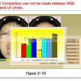 Looking for Distributor Digital Body Fat Caliper Skin Scanner Machine for Beauty Salon Use thumbnail-6