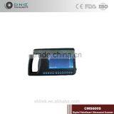 Top Sale CMS600S Digital PalmSmart Uitrasound Scanner
