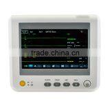 CE Mark Hospital Handheld Mini 7 Inch 6 Parameter Patient Monitor RPM-9000F Capnography Optional Printer thumbnail-2