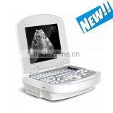 2017 Newest B/W Ultrasound Imaging System 3.5Mhz Convex Probe Laptop Ultrasound Scanner thumbnail-1