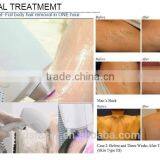 Newest Diode Laser Fhr System Manufacturer for Beauty Equipment thumbnail-4
