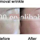 Cosmetic Surgery Beauty Equipment Laser Skin Cometic Surgery Use thumbnail-2