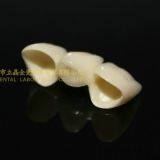 Dental Crown Zirconia PFZ, Dental Teeth, Dental Prosthesis, Laboratoire Dentaire, Dentallabor, Laboratorio Dental, Dental Laboratory, Shenzhen LJ Dental Lab China thumbnail-5