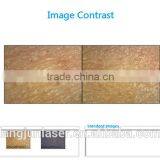 Home, Salons and Clinics Using Portable Skin Tightening Skin Analyzer thumbnail-2