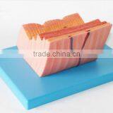 The Human Stomach Amplification Hierarchy Model of Gastric Digestive Department Special Amplification Model thumbnail-3