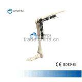 Orthofix External Fixation Orthopedic Surgical Instruments Knee Joint