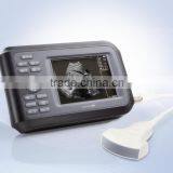 Factory Price!!CE Approved Notebook/ Handheld Ultrasound Scanner With 3.5Mhz Multi-frequency Convex Probe H8 thumbnail-2