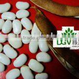 Whole Sale White Beans thumbnail-1