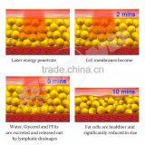 RF Vacuum Roller Machine Skin Lifting Ultrasonic Cavitation Facial Machine Price Ultrasound Weight Loss Machines thumbnail-4