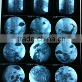 dental x ray film,x ray film suppliers,x ray film manufacturers